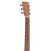 Martin 000-15E - Electro Acoustic Guitar - Image 4
